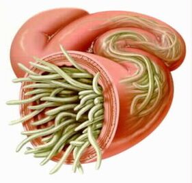 Parásitos en los intestinos