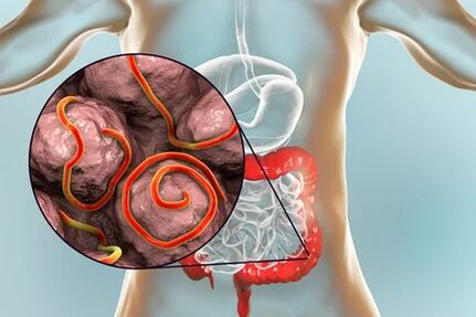 Parásitos en los intestinos