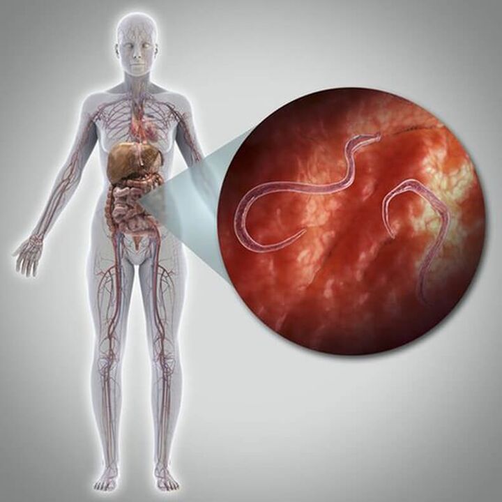 Parásitos en el cuerpo de una persona