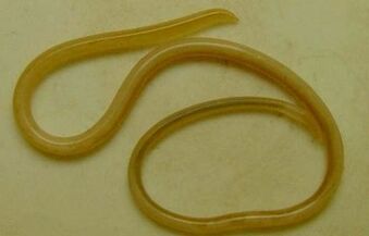 tipos de parásitos en el cuerpo humano