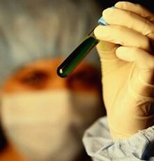 cómo hacerse la prueba de parásitos