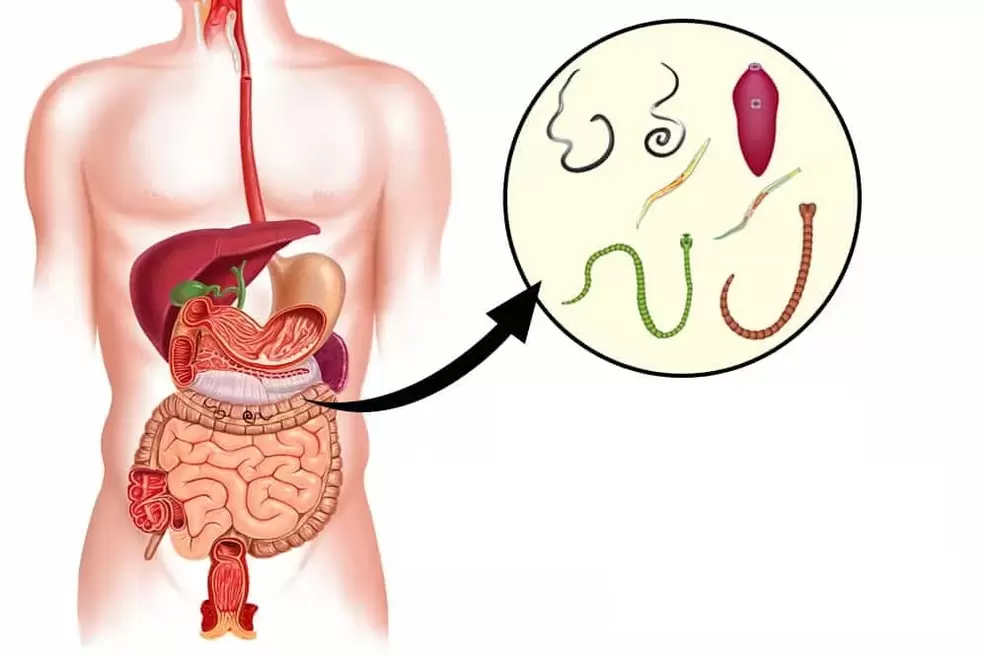 gusanos en el cuerpo humano
