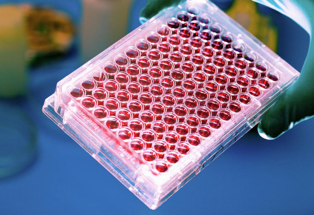 análisis de sangre para parásitos