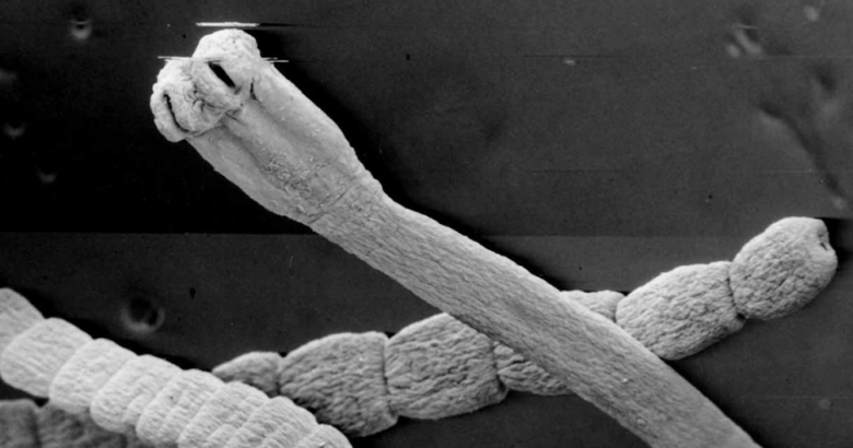 gusanos del cuerpo humano