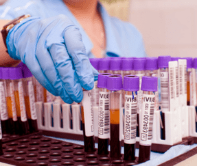 análisis de sangre para parásitos