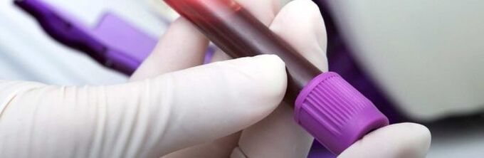 sangre para pruebas de parásitos