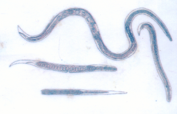 El gusano de Guinea, que parasita debajo de la piel, es fácil de infectar. 