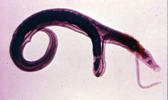 Los esquistosomas son uno de los parásitos más comunes y peligrosos. 