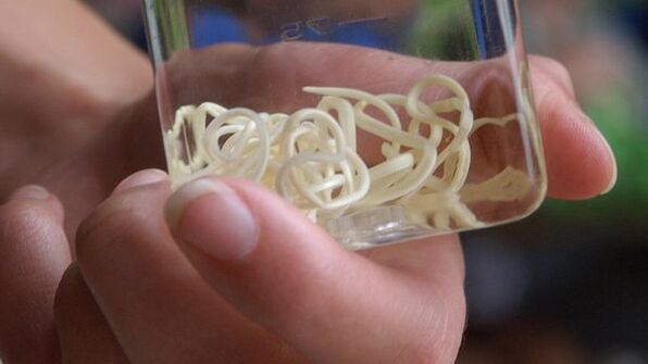 Los gusanos filaria se parecen a un hilo largo en apariencia. 